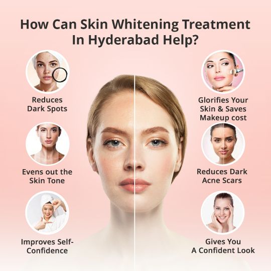 How can Skin Whitening Treatment in Hyderabad Helps: Improves Self-Confidence, Gives You a Confident Look, Reduces Dark Acne Scars & more.